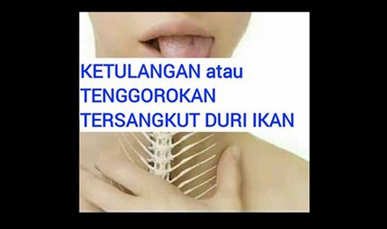 Cara Mengatasi Ketulangan: Solusi Praktis Dan Efektif Cara Mengatasi Ketulangan: Solusi Praktis Dan Efektif